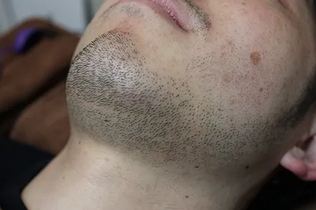 青髭がコンシーラーで隠れる理由｜“青く見える仕組み”を理解する