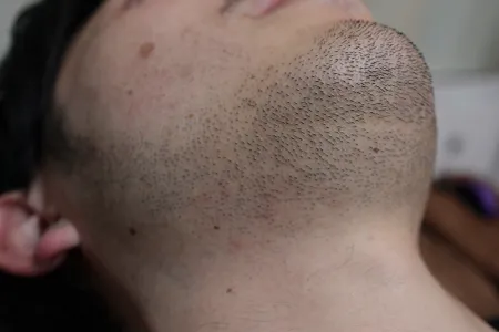 無精髭とは？どこから無精髭になるのか