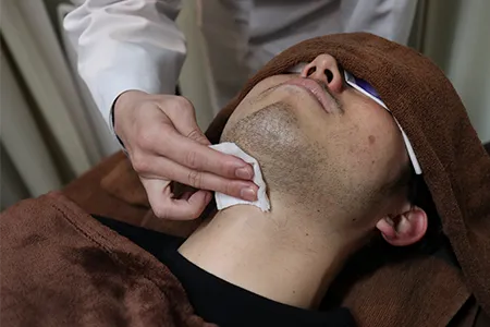 ヒゲ脱毛で肌荒れが起こる3つの原因