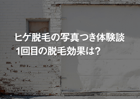 髭脱毛1回目の効果