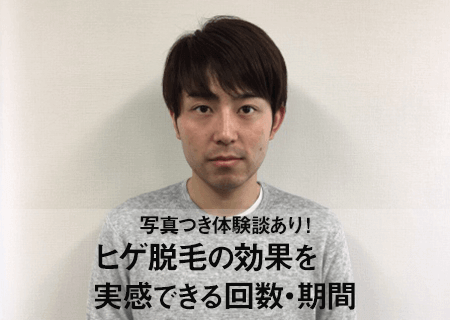 ヒゲ脱毛の効果を実感できるのは回数・期間