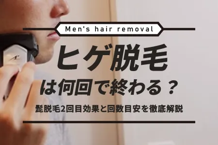 ヒゲ脱毛は何回で終わる？髭脱毛2回目効果と回数目安を徹底解説