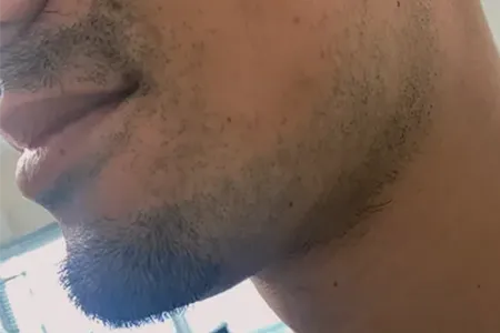 【先に結論】若いのに老けて見える原因は「青髭・肌影・習慣」の3つ