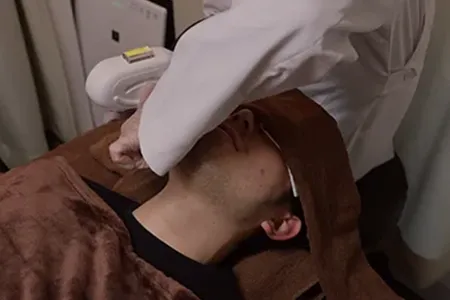 よくある質問｜髭が濃い人の悩み