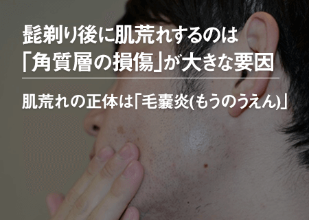 髭剃りで肌荒れしてしまうのは、「角質層の損傷」が大きな原因