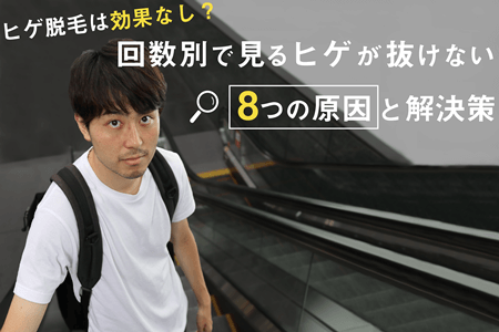 ヒゲ脱毛の効果が出ない原因と解決策