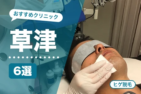 草津でヒゲ脱毛おすすめ6選!JR草津駅・南草津駅の安い医療クリニック比較