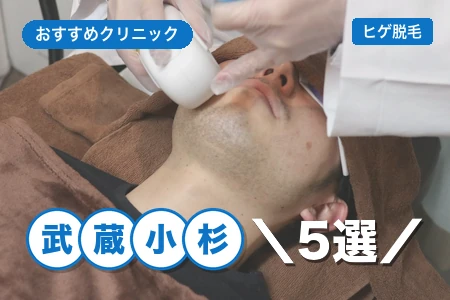 武蔵小杉でヒゲ脱毛おすすめ5選|武蔵小杉駅近で安い院は?