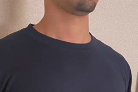 鳥肌のように毛穴がポツポツになる