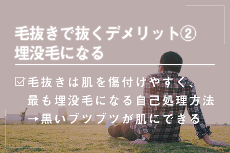 5-2.埋没毛になる