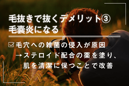 5-3.毛嚢炎になる